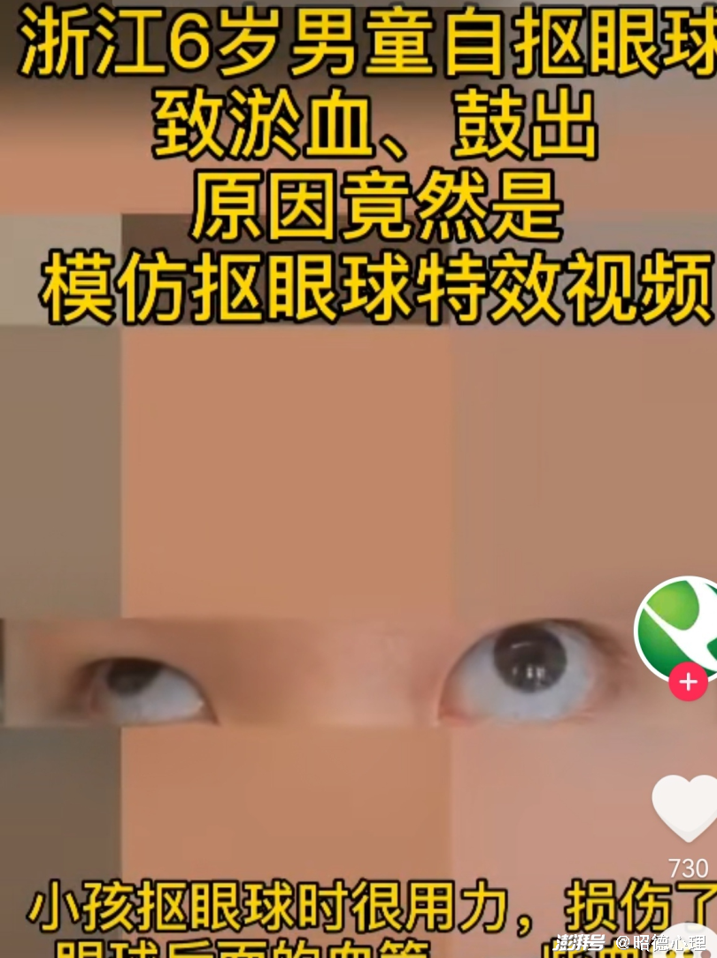 鱿鱼游戏争议_青少年沉迷精神垃圾_鱿鱼游戏最难发现的十个细节